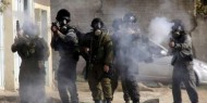 تصعيد خطير لليوم الثالث: شهيد وأكثر من 95 مصابا و30 معتقلا في العيسوية