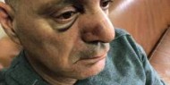 مستوطنون يعتدون بالضرب المبرح على شاب من القدس