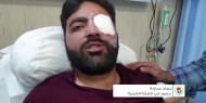 الرئيس للصحفي عمارنة: سنوفر لك العلاج اينما كان