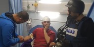 الخليل: إصابة صحفي بقنبلة غاز في الرأس والعشرات بالاختناق خلال مسيرة منددة بـ"صفقة القرن"