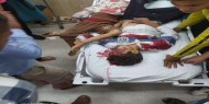 المستشفيات المصرية في شمال سيناء تعلن جاهزيتها لاستقبال مصابي العداون الإسرائيلي في غزة
