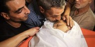 الحركة العالمية للدفاع عن الأطفال: الاحتلال يستهدف الأطفال بالأجزاء العليا من الجسد بشكل ممنهج