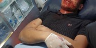 عمر عاصي.. قنبلة صوت أفقدته البصر