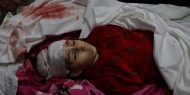 حصيلة العدوان على غزة: 33 شهيدا وعشرات الإصابات وتدمير للمنازل والبنية التحتية