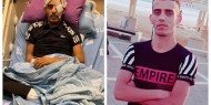 استشهاد شاب مقدسي متأثرا باصابته برصاص الاحتلال قبل نحو عامين