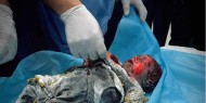 في اليوم الـ148 من العدوان: عشرات الشهداء والجرحى في قصف الاحتلال المتواصل على قطاع غزة