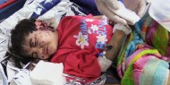الإحصاء المركزي: 65% من الشهداء هم من الأطفال والنساء