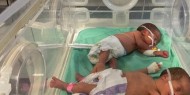 بسبب نقص الوقو: 130 من الأطفال الخدج معرضون للخطر