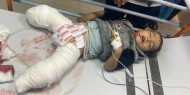 "اليونيسيف": الأطفال الذين يتعافون من البتر بمستشفيات غزة يُقتلون فيها