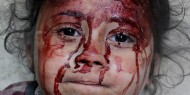 استشهاد 13 مواطنا في عدة غارات على قطاع غزة