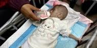 "الصحة العالمية": 100 ألف طفل في غزة سيعانون سوء تغذية حاد بحلول نيسان المقبل