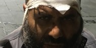 هيئة الأسرى تنشر صوراً لمرابطين بالأقصى تعرضوا للضرب والتنكيل أثناء الاعتقال